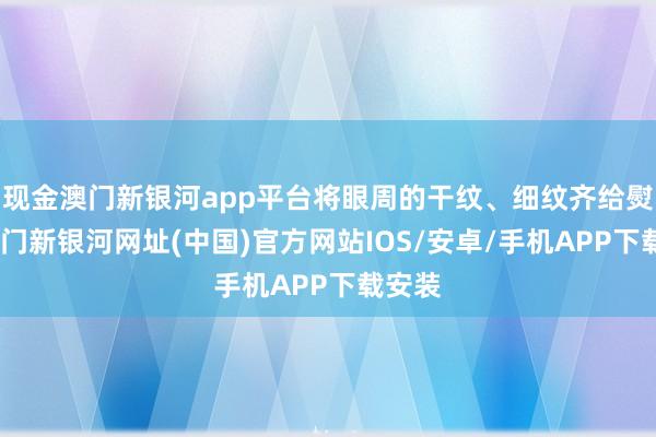 现金澳门新银河app平台将眼周的干纹、细纹齐给熨平-澳门新银河网址(中国)官方网站IOS/安卓/手机APP下载安装